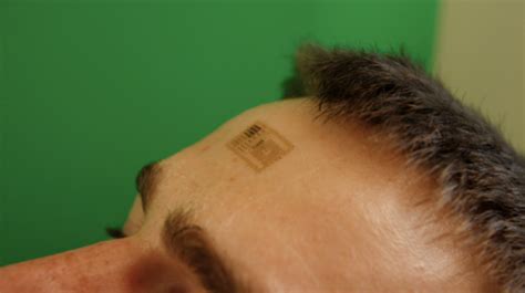 rfid chip tattoo|rfid chip replacement.